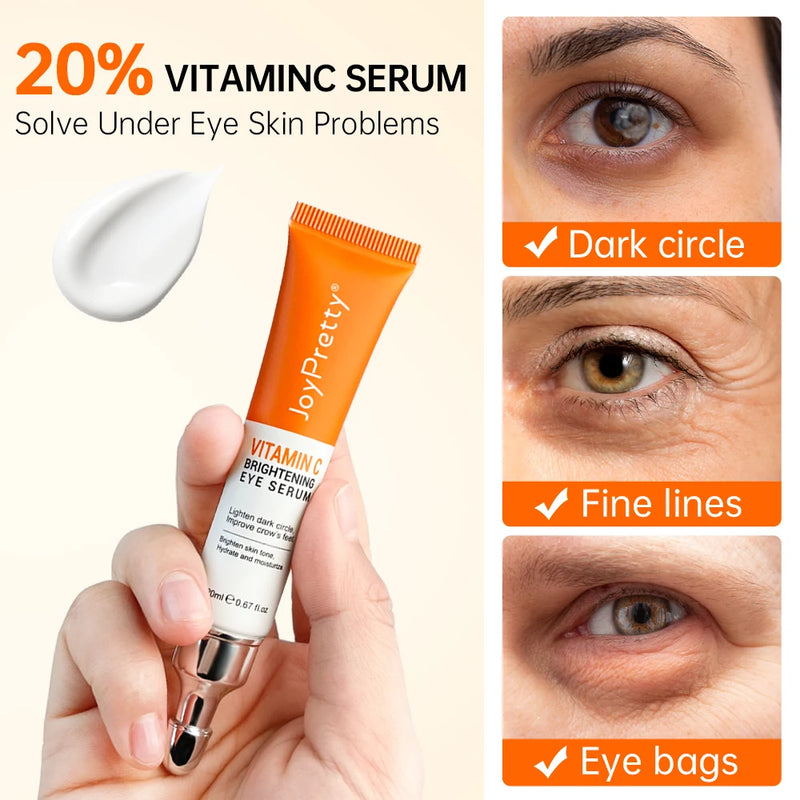 Creme antiolheiras para os olhos